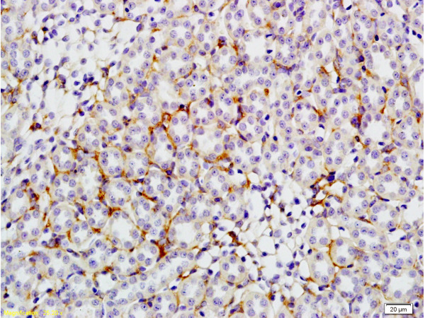 Formalin-fixed and paraffin embedded: rat kidney tissue labeled with Anti-GLUT4 Polyclonal Antibody (bs-0384R), Unconjugated at 1:200, followed by conjugation to the secondary antibody and DAB staining