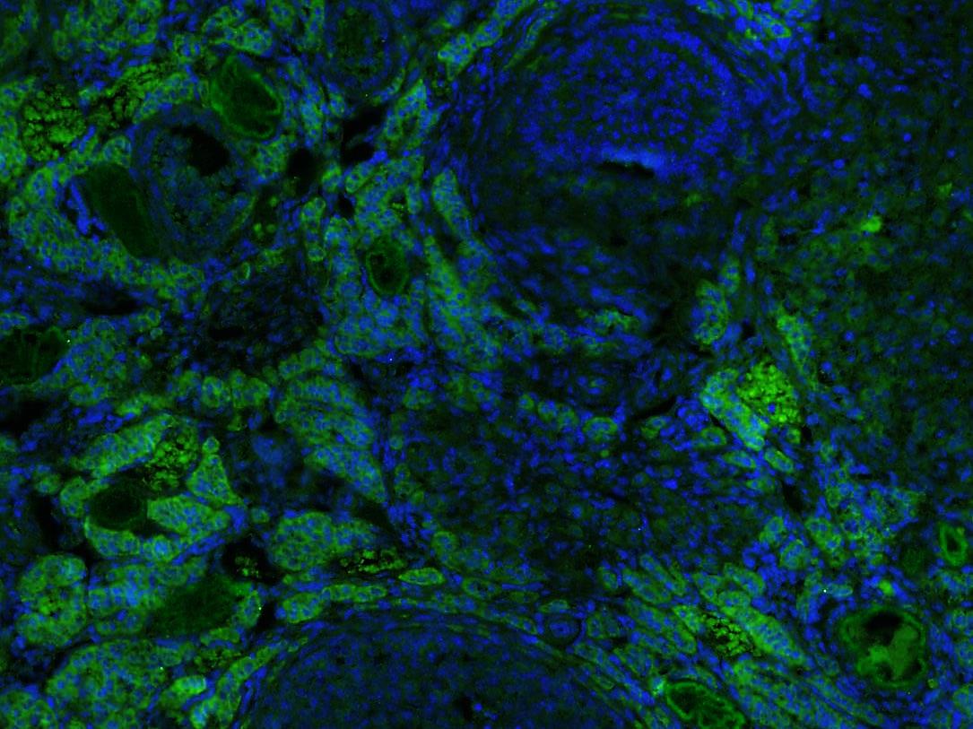Paraformaldehyde-fixed, paraffin embedded Mouse Ovary; Antigen retrieval by boiling in sodium citrate buffer (pH6.0) for 15min; Block endogenous peroxidase by 3% hydrogen peroxide for 20 minutes; Blocking buffer (normal goat serum) at 37°C for 30min; Antibody incubation with KIF13B Polyclonal Antibody, Unconjugated (bs-12387R) at 1:200 overnight at 4°C, followed by a conjugated Goat Anti-Rabbit IgG antibody (bs-0295G-AF488) for 90 minutes, and DAPI for nuclei staining.