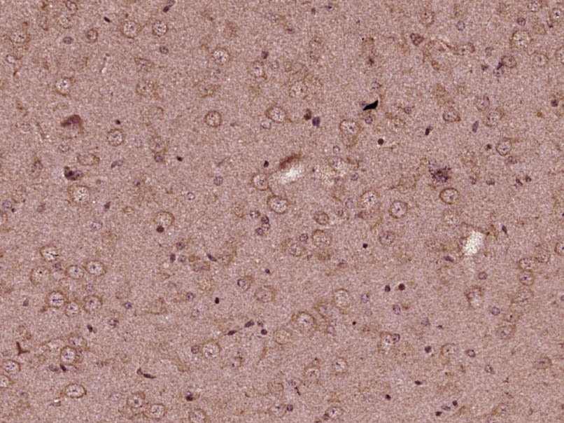 Paraformaldehyde-fixed, paraffin embedded Mouse Brain; Antigen retrieval by boiling in sodium citrate buffer (pH6.0) for 15min; Block endogenous peroxidase by 3% hydrogen peroxide for 20 minutes; Blocking buffer (normal goat serum) at 37°C for 30min; Antibody incubation with KIF13B Polyclonal Antibody, Unconjugated (bs-12387R) at 1:400 overnight at 4°C, followed by secondary and DAB staining.