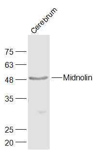Lane 1: Mouse Cerebrum; Probed with Midnolin Polyclonal Antibody, Unconjugated (bs-0762R) at 1:1000 overnight at 4°C followed by a conjugated secondary antibody for 60 minutes at 37°C. Lane 1: Mouse Cerebrum; Probed with Midnolin Polyclonal Antibody, Unconjugated (bs-0762R) at 1:1000 overnight at 4°C followed by a conjugated secondary antibody for 60 minutes at 37°C.
