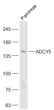 Lane 1: Mouse Pancreas; Probed with ADCY5 Polyclonal Antibody, Unconjugated (bs-3922R) at 1:1000 overnight at 4°C followed by a conjugated secondary antibody for 60 minutes at 37°C.