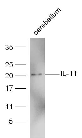 Mouse cerebellum lysates probed with IL-11 Polyclonal Antibody, Unconjugated (bs-1827R) at 1:300 dilution and 4˚C overnight incubation. Followed by conjugated secondary antibody incubation at 1:20000 for 60 min at 37˚C.