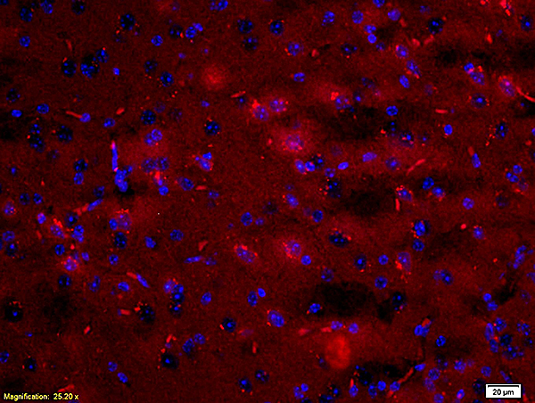 Formalin-fixed and paraffin embedded: rat brain tissue labeled with Anti-ARC Polyclonal Antibody (bs-0385R), Unconjugated  at 1:200, followed by conjugation to the secondary antibody was Goat Anti-Rabbit IgG, PE conjugated (bs-0295G-PE) at 1:200 for 40 minutes at 37\u00b0C DAPI(5ug\/ml, blue) was used to stain the cell nuclei