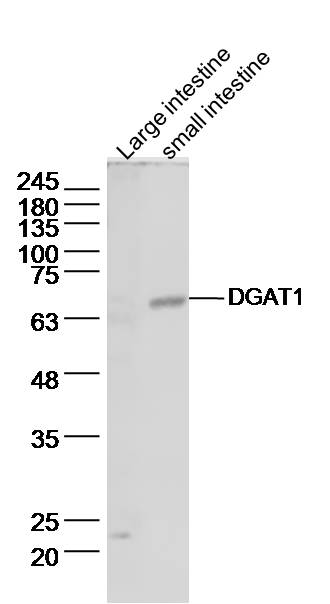 Lane 1: Mouse Large intestine lysates; Lane 2: Mouse intestine lysates probed with DGAT1 Polyclonal Antibody, Unconjugated (bs-2332R) at 1:500 dilution and 4˚C overnight incubation. Followed by conjugated secondary antibody incubation at 1:20000 for 60 min at 37˚C.
