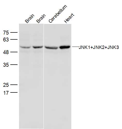 Lane 1: Mouse Cerebrum lysates;Lane 2: Rat Cerebrum lysates;Lane 3: Mouse Cerebellum lysates; Lane 4: Mouse heart lysates probed with JNK1+2+3 Polyclonal Antibody, Unconjugated (bs-2592R) at 1:300 dilution and 4˚C overnight incubation. Followed by conjugated secondary antibody incubation at 1:20000 for 60 min at 37˚C.