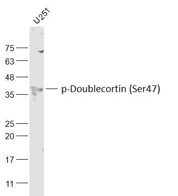 U251 cell lysates probed with Doublecortin (Ser47) Polyclonal Antibody, Unconjugated (bs-3113R) at 1:1000 dilution and 4˚C overnight incubation. Followed by conjugated secondary antibody incubation at 1:20000 for 60 min at 37˚C.