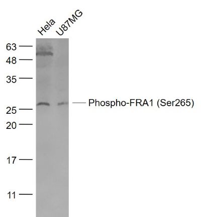 Lane 1: Hela cell lysates; Lane 2: U87MG cell lysates probed with Phospho-FRA1 (Ser265) Polyclonal Antibody, Unconjugated (bs-3158R) at 1:1000 dilution and 4˚C overnight incubation. Followed by conjugated secondary antibody incubation at 1:20000 for 60 min at 37˚C.