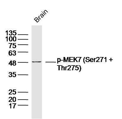 Mouse cerebrum lysates probed with Phospho-MEK7 (Ser271 + Thr275) Polyclonal Antibody, Unconjugated (bs-3277R) at 1:300 dilution and 4˚C overnight incubation. Followed by conjugated secondary antibody incubation at 1:20000 for 60 min at 37˚C.