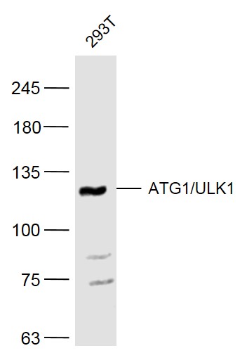 293T cell lysates probed with ATG1/ULK1 Polyclonal Antibody, Unconjugated (bs-3602R) at 1:500 dilution and 4˚C overnight incubation. Followed by conjugated secondary antibody incubation at 1:20000 for 60 min at 37˚C.