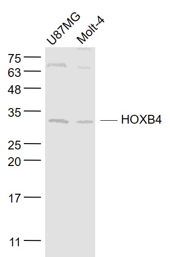 Lane 1: U87MG cell lysates; Lane 2: Molt-4 cell lysates probed with HOXB4 Polyclonal Antibody, Unconjugated (bs-3650R) at 1:1000 dilution and 4˚C overnight incubation. Followed by conjugated secondary antibody incubation at 1:20000 for 60 min at 37˚C.