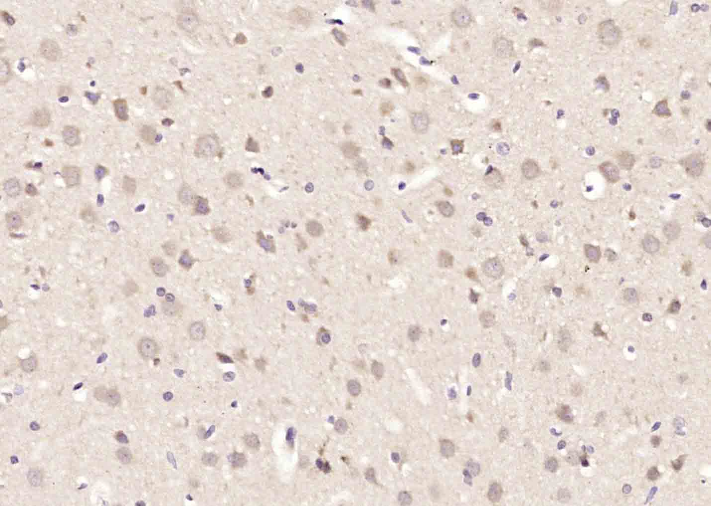 Paraformaldehyde-fixed, paraffin-embedded Rat Brain; Antigen retrieval by boiling in sodium citrate buffer (pH6.0) for 15min; Block endogenous peroxidase by 3% hydrogen peroxide for 20 minutes; Blocking buffer (normal goat serum) at 37°C for 30min; Antibody incubation with ATF2 (Thr69/71) Polyclonal Antibody, Unconjugated (bs-3033R) at 1:200 overnight at 4°C, followed by secondary and DAB staining.