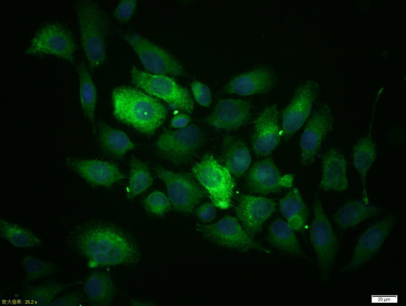 MCF-7 cells were stained with MUC1 Polyclonal Antibody, Unconjugated(bs-1497R) at 1:100 in PBS and incubated for two hours at 37°C followed by Goat Anti-Rabbit IgG (H+L) FITC conjugated secondary antibody. DAPI staining of the nucleus was done and then detected.