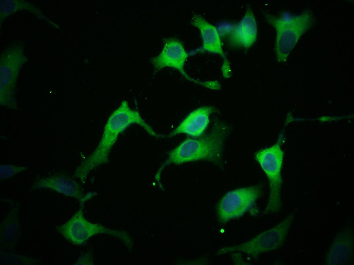 HeLa cells were stained with Kir6.2 (KCNJ11) Polyclonal Antibody, Unconjugated (bs-2436R) at 1:100 in PBS and incubated for two hours at 37°C followed by Goat Anti-Rabbit IgG (H+L) FITC conjugated secondary antibody. DAPI staining of the nucleus was done and then detected.