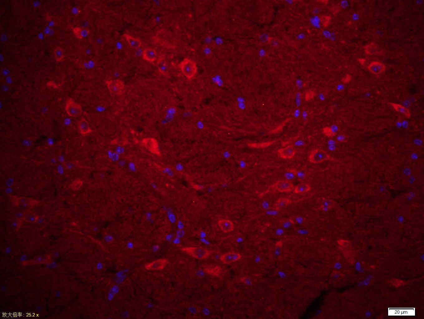 Paraformaldehyde-fixed, paraffin embedded Mouse brain; Antigen retrieval by boiling in sodium citrate buffer (pH6.0) for 15min; Blocking buffer (normal goat serum) at 37°C for 30min; Incubation: Anti-SPAG6 Antibody, conjugated (bs-12291R-Cy3) at 1:200 overnight at 4°C; DAPI (5ug/ml, blue) was used to stain the cell nuclei.