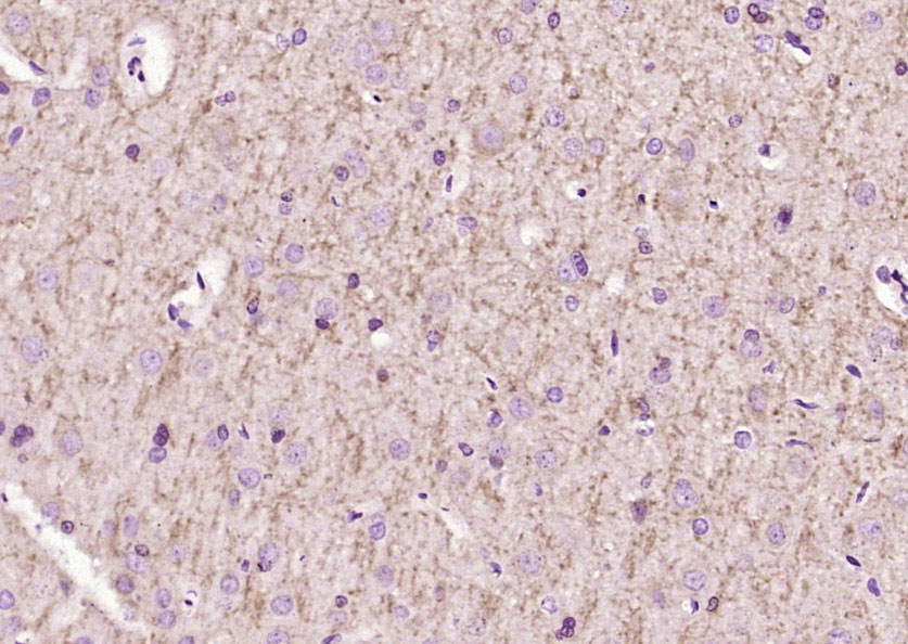 Paraformaldehyde-fixed, paraffin embedded Rat brain; Antigen retrieval by boiling in sodium citrate buffer (pH6.0) for 15min; Block endogenous peroxidase by 3% hydrogen peroxide for 20 minutes; Blocking buffer (normal goat serum) at 37°C for 30min; Antibody incubation with Lingo-1 Polyclonal Antibody, Unconjugated (bs-1177R) at 1:200 overnight at 4°C, DAB staining.