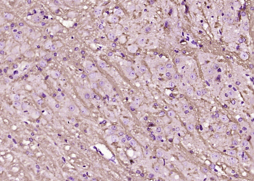 Paraformaldehyde-fixed, paraffin embedded Mouse cerebellum; Antigen retrieval by boiling in sodium citrate buffer (pH6.0) for 15min; Block endogenous peroxidase by 3% hydrogen peroxide for 20 minutes; Blocking buffer (normal goat serum) at 37°C for 30min; Antibody incubation with Lingo-1 Polyclonal Antibody, Unconjugated (bs-1177R) at 1:200 overnight at 4°C, DAB staining.