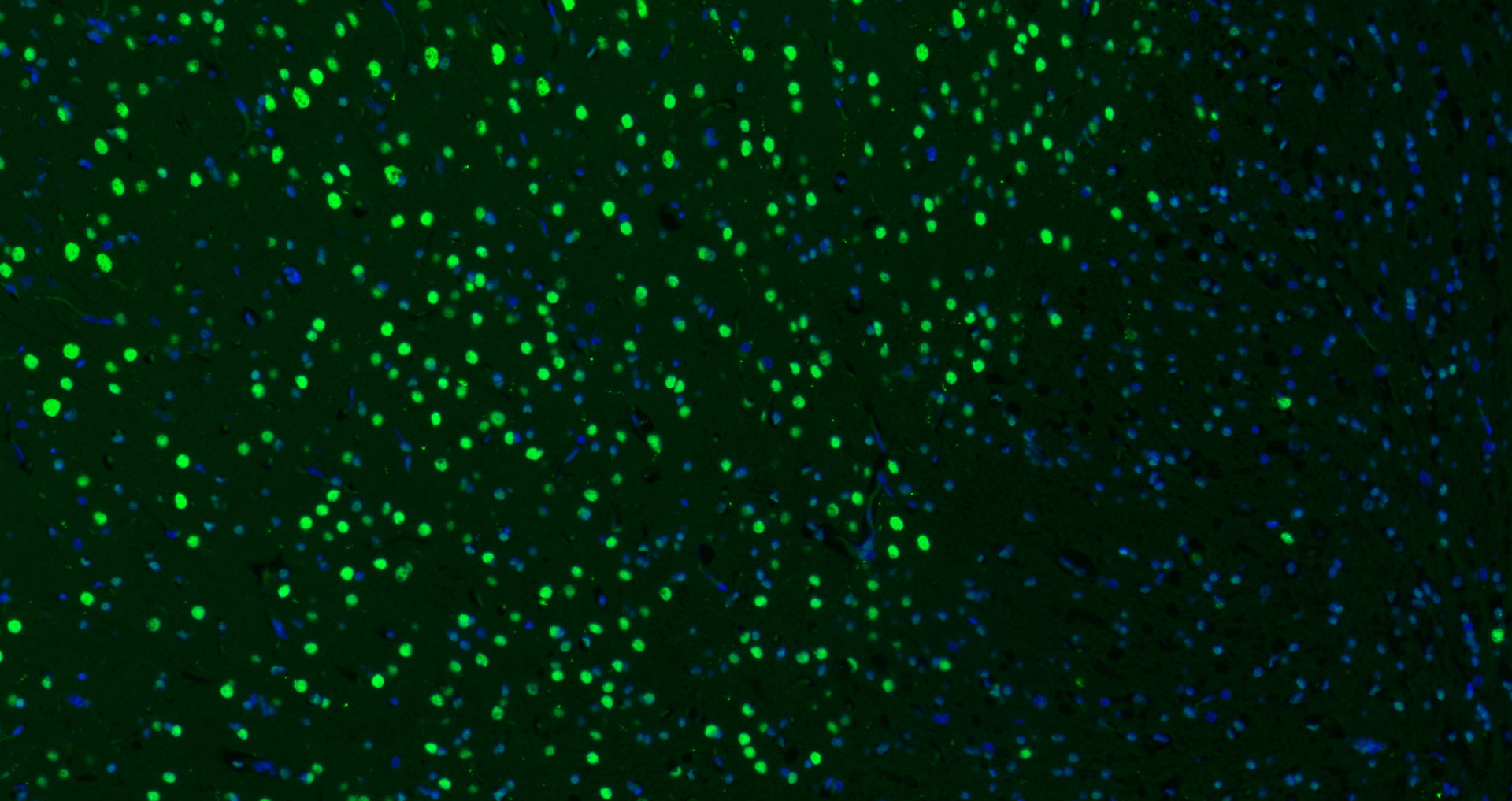Paraformaldehyde-fixed, paraffin embedded Rat brain; Antigen retrieval by boiling in sodium citrate buffer (pH6.0) for 15min; Block endogenous peroxidase by 3% hydrogen peroxide for 20 minutes; Blocking buffer (normal goat serum) at 37°C for 30min; Antibody incubation with B MyB Polyclonal Antibody, Unconjugated (bs-5960R) at 1:200 overnight at 4°C, DAB staining.