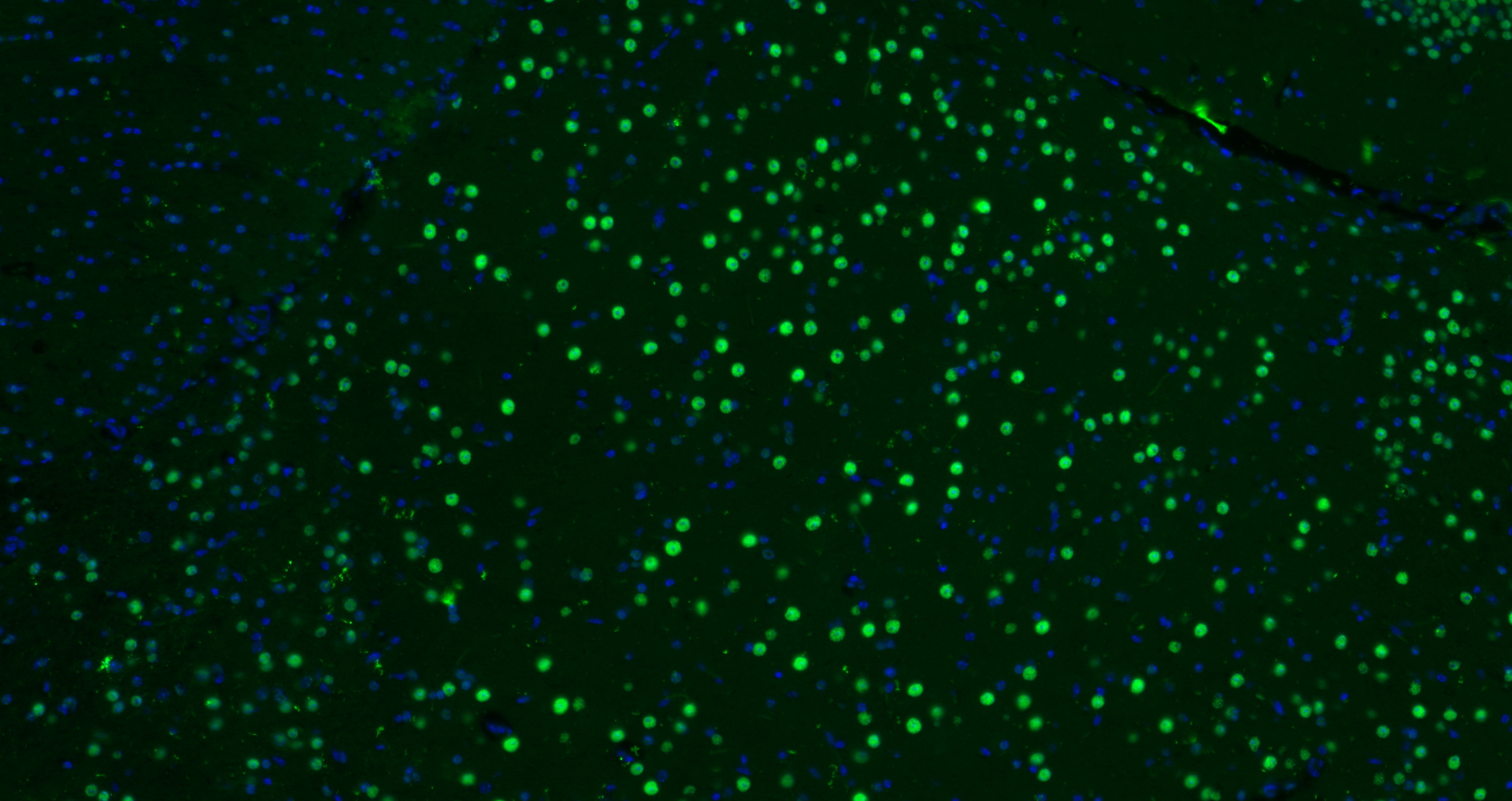 Paraformaldehyde-fixed, paraffin embedded Mouse brain; Antigen retrieval by boiling in sodium citrate buffer (pH6.0) for 15min; Block endogenous peroxidase by 3% hydrogen peroxide for 20 minutes; Blocking buffer (normal goat serum) at 37°C for 30min; Antibody incubation with B MyB Polyclonal Antibody, Unconjugated (bs-5960R) at 1:200 overnight at 4°C, DAB staining.