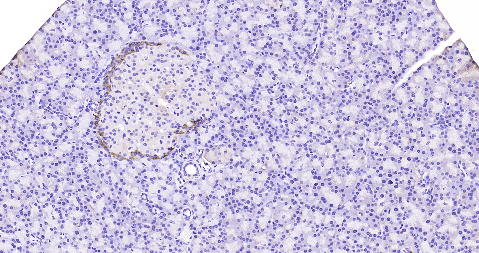 Paraformaldehyde-fixed, paraffin embedded Rat pancreas; Antigen retrieval by boiling in sodium citrate buffer (pH6.0) for 15min; Block endogenous peroxidase by 3% hydrogen peroxide for 20 minutes; Blocking buffer (normal goat serum) at 37°C for 30min; Antibody incubation with Tuberin Polyclonal Antibody, Unconjugated (bs-3586R) at 1:200 overnight at 4°C, DAB staining.