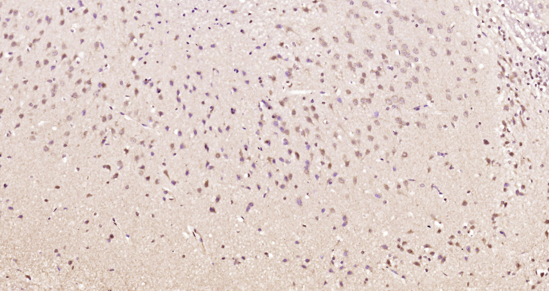 Paraformaldehyde-fixed, paraffin embedded Rat brain; Antigen retrieval by boiling in sodium citrate buffer (pH6.0) for 15min; Block endogenous peroxidase by 3% hydrogen peroxide for 20 minutes; Blocking buffer (normal goat serum) at 37°C for 30min; Antibody incubation with LPL protein/Lipoprotein lipase Polyclonal Antibody, Unconjugated (bs-2336R) at 1:200 overnight at 4°C, DAB staining.