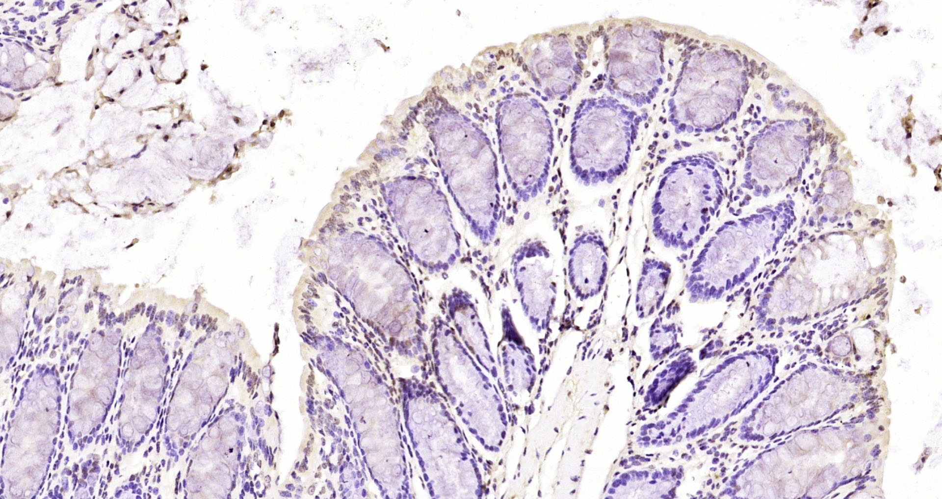 Paraformaldehyde-fixed, paraffin embedded Mouse colon; Antigen retrieval by boiling in sodium citrate buffer (pH6.0) for 15min; Block endogenous peroxidase by 3% hydrogen peroxide for 20 minutes; Blocking buffer (normal goat serum) at 37°C for 30min; Antibody incubation with SMC1 (Ser360) Polyclonal Antibody, Unconjugated (bs-3406R) at 1:200 overnight at 4°C, DAB staining.