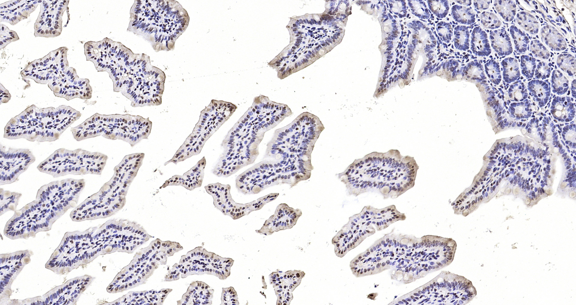 Paraformaldehyde-fixed, paraffin embedded Mouse intestine; Antigen retrieval by boiling in sodium citrate buffer (pH6.0) for 15min; Block endogenous peroxidase by 3% hydrogen peroxide for 20 minutes; Blocking buffer (normal goat serum) at 37°C for 30min; Antibody incubation with Stat4 (Tyr693) Polyclonal Antibody, Unconjugated (bs-3430R) at 1:200 overnight at 4°C, DAB staining.