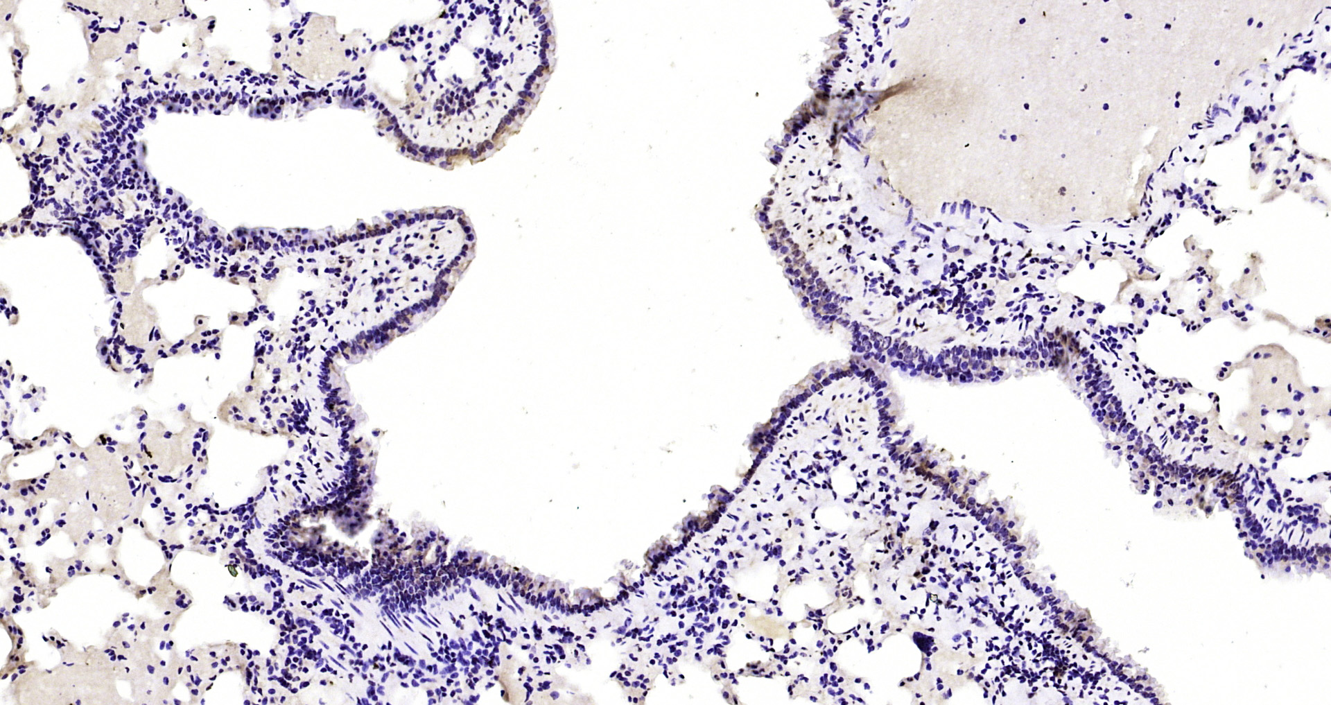 Paraformaldehyde-fixed, paraffin embedded Mouse lung; Antigen retrieval by boiling in sodium citrate buffer (pH6.0) for 15min; Block endogenous peroxidase by 3% hydrogen peroxide for 20 minutes; Blocking buffer (normal goat serum) at 37°C for 30min; Antibody incubation with CUEDC2 Polyclonal Antibody, Unconjugated (bs-4608R) at 1:200 overnight at 4°C, DAB staining.