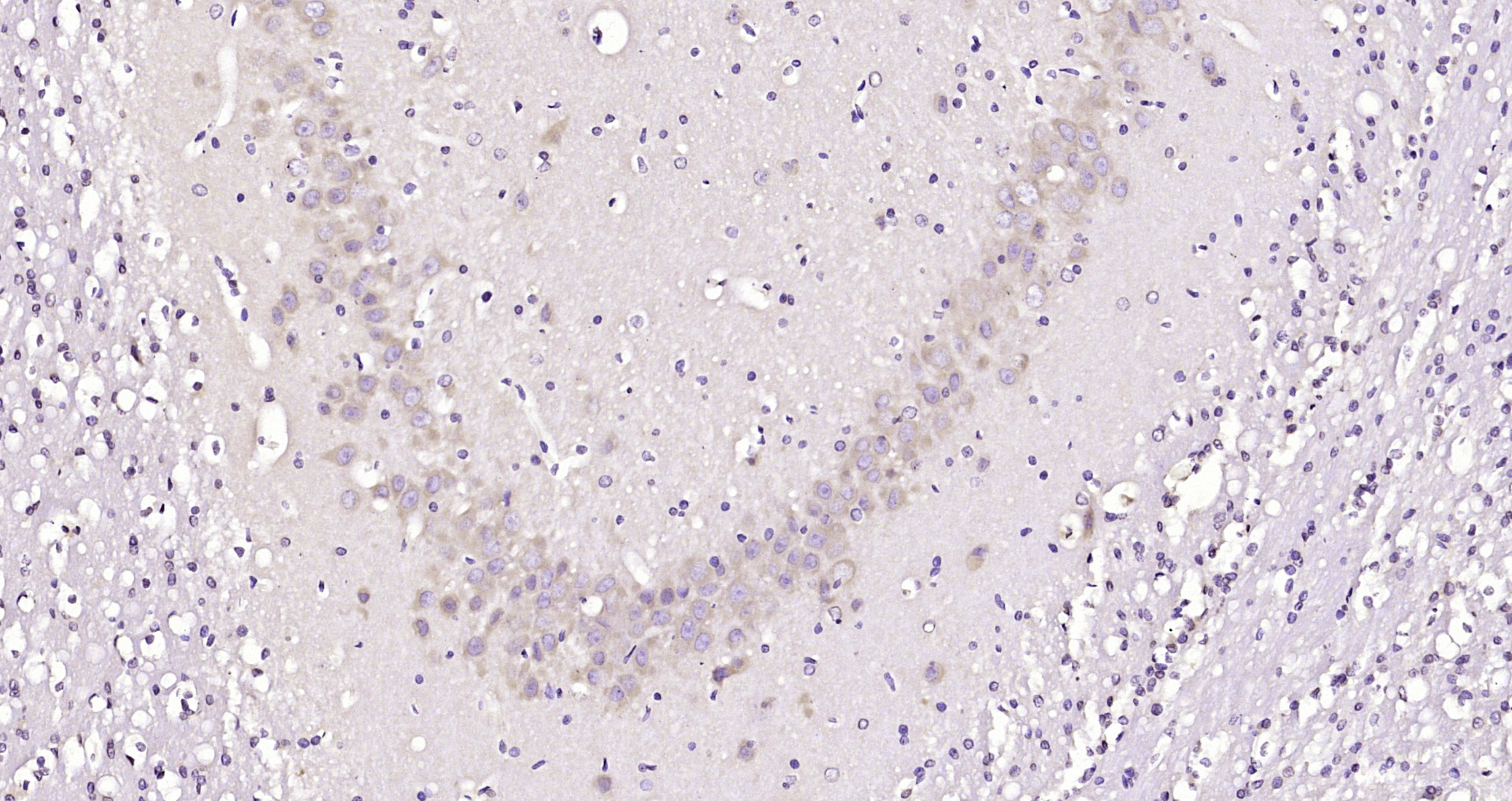 Paraformaldehyde-fixed, paraffin embedded Rat brain; Antigen retrieval by boiling in sodium citrate buffer (pH6.0) for 15min; Block endogenous peroxidase by 3% hydrogen peroxide for 20 minutes; Blocking buffer (normal goat serum) at 37°C for 30min; Antibody incubation with STK40 Polyclonal Antibody, Unconjugated (bs-6899R) at 1:200 overnight at 4°C, DAB staining.