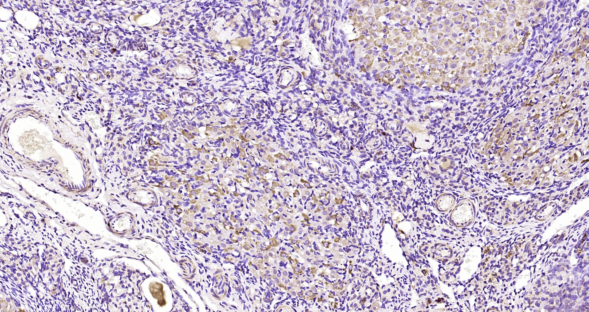 Paraformaldehyde-fixed, paraffin embedded Rat Ovary; Antigen retrieval by boiling in sodium citrate buffer (pH6.0) for 15min; Block endogenous peroxidase by 3% hydrogen peroxide for 20 minutes; Blocking buffer (normal goat serum) at 37°C for 30min; Antibody incubation with TCAB1 Polyclonal Antibody, Unconjugated (bs-8163R) at 1:200 overnight at 4°C, DAB staining.