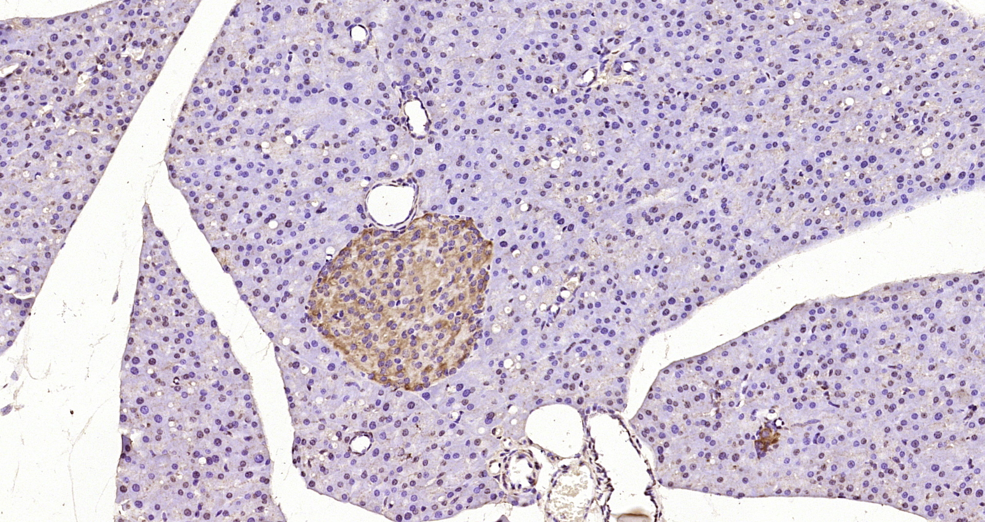 Paraformaldehyde-fixed, paraffin embedded Mouse pancreas; Antigen retrieval by boiling in sodium citrate buffer (pH6.0) for 15min; Block endogenous peroxidase by 3% hydrogen peroxide for 20 minutes; Blocking buffer (normal goat serum) at 37°C for 30min; Antibody incubation with DEPTOR Polyclonal Antibody, Unconjugated (bs-8255R) at 1:200 overnight at 4°C, DAB staining. Paraformaldehyde-fixed, paraffin embedded Mouse pancreas; Antigen retrieval by boiling in sodium citrate buffer (pH6.0) for 15min; Block endogenous peroxidase by 3% hydrogen peroxide for 20 minutes; Blocking buffer (normal goat serum) at 37°C for 30min; Antibody incubation with DEPTOR Polyclonal Antibody, Unconjugated (bs-8255R) at 1:200 overnight at 4°C, DAB staining.