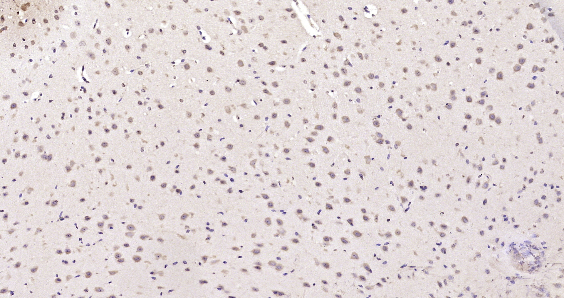 Paraformaldehyde-fixed, paraffin embedded Mouse brain; Antigen retrieval by boiling in sodium citrate buffer (pH6.0) for 15min; Block endogenous peroxidase by 3% hydrogen peroxide for 20 minutes; Blocking buffer (normal goat serum) at 37°C for 30min; Antibody incubation with α-TAT Polyclonal Antibody, Unconjugated (bs-9535R) at 1:200 overnight at 4°C, DAB staining.