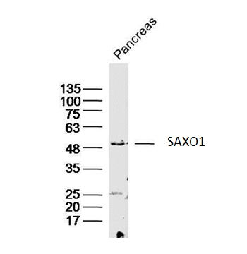 Lane 1: Mouse Pancreas; Probed with SAXO1 Polyclonal Antibody, Unconjugated (bs-8222R) at 1:300 overnight at 4°C followed by a conjugated secondary antibody for 60 minutes at 37°C.