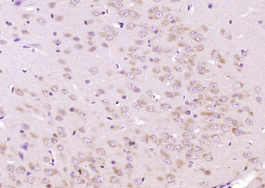 Paraformaldehyde-fixed, paraffin-embedded Rat Brain; Antigen retrieval by boiling in sodium citrate buffer (pH6.0) for 15min; Block endogenous peroxidase by 3% hydrogen peroxide for 20 minutes; Blocking buffer (normal goat serum) at 37°C for 30min; Antibody incubation with FBXO45 Polyclonal Antibody, Unconjugated (bs-13150R) at 1:200 overnight at 4°C, followed by secondary and DAB staining.