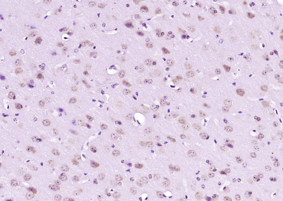 Paraformaldehyde-fixed, paraffin-embedded Mouse Brain; Antigen retrieval by boiling in sodium citrate buffer (pH6.0) for 15min; Block endogenous peroxidase by 3% hydrogen peroxide for 20 minutes; Blocking buffer (normal goat serum) at 37°C for 30min; Antibody incubation with FBXO45 Polyclonal Antibody, Unconjugated (bs-13150R) at 1:200 overnight at 4°C, followed by secondary and DAB staining.