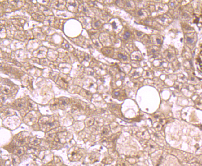 Paraformaldehyde-fixed and paraffin-embedded Human Liver tissue incubated with Annexin A2 (2F4) Monoclonal Antibody (bsm-54021R) at 1:100, overnight at 4°C, followed by a conjugated secondary antibody and DAB staining. Counterstained with hematoxylin.