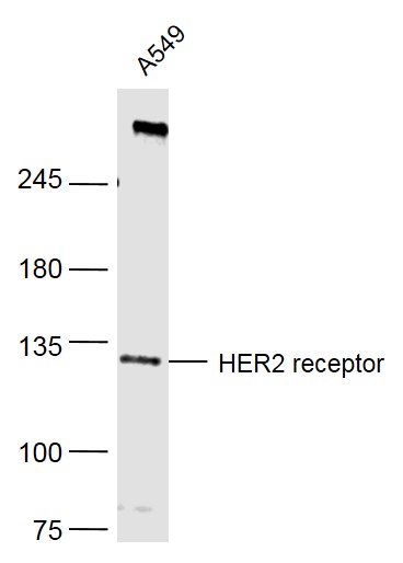 Lane 1: A549 Cells; Probed with HER2 receptor(1A4) Monoclonal Antibody (bsm-2156M) at 1:500 overnight at 4°C followed by a conjugated secondary antibody for 60 minutes at 37°C.