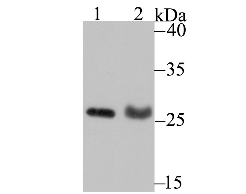 Lane 1: MCF-7 Cells; Lane 2: Rat Lung; Probed with _x000D_ PSME1 (1C4) Monoclonal Antibody (bsm-54246R) at 1:500 overnight at 4°C followed by a conjugated secondary antibody for 60 minutes at 37°C._x000D_ Lane 1: MCF-7 Cells; Lane 2: Rat Lung; Probed with _x000D_ PSME1 (1C4) Monoclonal Antibody (bsm-54246R) at 1:500 overnight at 4°C followed by a conjugated secondary antibody for 60 minutes at 37°C._x000D_