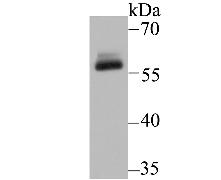 Lane 1: A431 Cells; Probed with DKC1 (5C7) Monoclonal Antibody (bsm-54241R) at 1:500 overnight at 4°C followed by a conjugated secondary antibody for 60 minutes at 37°C.