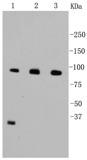 Lane 1: SW480; Lane 2: HT29; Lane 3: A431; Probed with Beta-Catenin (1A5) Monoclonal Antibody (bsm-52263R) at 1:1000 overnight at 4°C followed by a conjugated secondary antibody for 60 minutes at 37°C.
