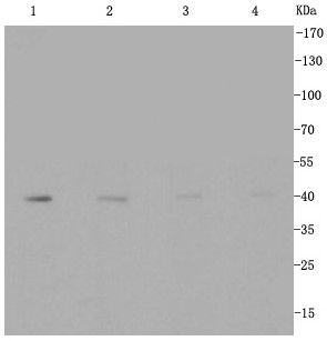 Lane 1: Hela; Lane 2: MCF-7; Lane 3: Jurkat; Lane 4: NIH/3T3; Probed with CDT1 (2H5) Monoclonal Antibody (bsm-54038R) at 1:1000 overnight at 4°C followed by a conjugated secondary antibody for 60 minutes at 37°C. Lane 1: Hela; Lane 2: MCF-7; Lane 3: Jurkat; Lane 4: NIH/3T3; Probed with CDT1 (2H5) Monoclonal Antibody (bsm-54038R) at 1:1000 overnight at 4°C followed by a conjugated secondary antibody for 60 minutes at 37°C.