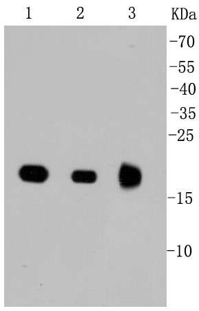 Lane 1: MCF-7; Lane 2: 293T; Lane 3: Mouse brain; Probed with Ras (11F2) Monoclonal Antibody (bsm-52246R) at 1:1000 overnight at 4°C followed by a conjugated secondary antibody for 60 minutes at 37°C.