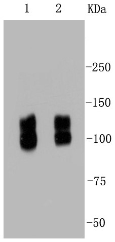 Lane 1: Hela; Lane 2: NIH/3T3; Probed with Integrin beta 1 (1G11) Monoclonal Antibody (bsm-52247R) at 1:1000 overnight at 4°C followed by a conjugated secondary antibody for 60 minutes at 37°C. Lane 1: Hela; Lane 2: NIH/3T3; Probed with Integrin beta 1 (1G11) Monoclonal Antibody (bsm-52247R) at 1:1000 overnight at 4°C followed by a conjugated secondary antibody for 60 minutes at 37°C.
