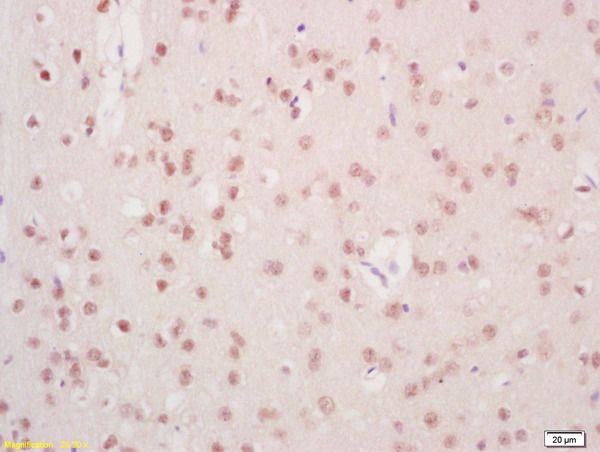 Formalin-fixed and paraffin embedded rat brain labeled with Anti-Mre11\/HNGS1 Polyclonal Antibody, Unconjugated (bs-3503R) at 1:200, followed by conjugation to the secondary antibody and DAB staining