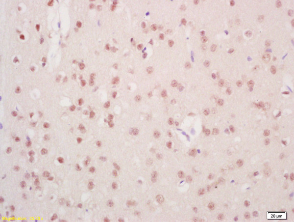 Formalin-fixed and paraffin embedded rat brain labeled with Anti-Mre11/HNGS1 Polyclonal Antibody, Unconjugated (bs-3503R) at 1:200, followed by conjugation to the secondary antibody and DAB staining