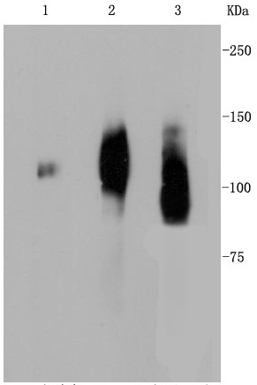 Lane 1: Human placenta; Lane 2: JAR; Lane 3: Human liver lysate; Probed with LAMP2a (2C4 ) Monoclonal Antibody (bsm-52255R) at 1:1000 overnight at 4°C followed by a conjugated secondary antibody for 60 minutes at 37°C. Lane 1: Human placenta; Lane 2: JAR; Lane 3: Human liver lysate; Probed with LAMP2a (2C4 ) Monoclonal Antibody (bsm-52255R) at 1:1000 overnight at 4°C followed by a conjugated secondary antibody for 60 minutes at 37°C.