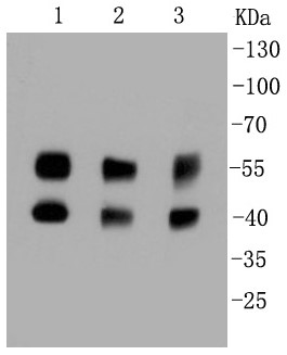 Lane 1: Hela; Lane 2: PC12; Lane 3: K562 lysate probed with JNK1+JNK2+JNK3 (3G7) Monoclonal Antibody (bsm-52258R) overnight at 4°C followed by a conjugated secondary antibody for 60 minutes at 37°C.