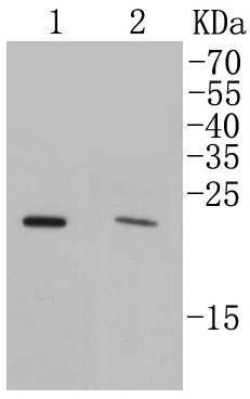 Lane 1: MCF-7; Lane 2: 293T lysates probed with _x000D_ Rab4A (4B5) Monoclonal Antibody (bsm-52269R) at 1:500 dilution and incubated overnight at 4°C, followed by a conjugated secondary antibody for 60 minutes at 37°C.