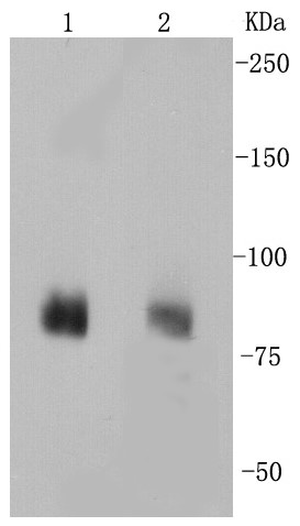 Lane 1: Mouse brain; Lane 2: Human brain lysate probed with _x000D_ DLG4 (1H8) Monoclonal Antibody (bsm-52272R) at 1:1000 overnight at 4°C followed by a conjugated secondary antibody for 60 minutes at 37°C.