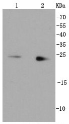 Lane 1: HepG2; Lane 2: K562 lysate probed with Rab9 (4A8 ) Monoclonal Antibody (bsm-52279R) at 1:1000 overnight at 4°C followed by a conjugated secondary antibody for 60 minutes at 37°C.