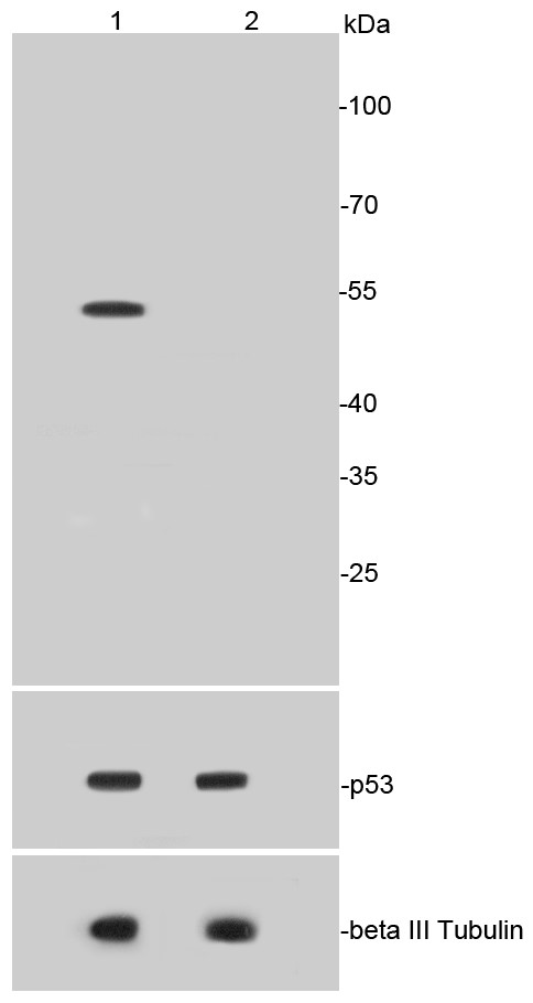 Lane 1: HepG2 treated with Etoposide 20uM and Trichostatin A 500 nM for 6 hours, whole cell lysates (positive control); Lane 2: untreated HepG2, whole cell lysates; probed with p53(acetyl K370) (2F1) Monoclonal Antibody, Unconjugated (bsm-52288R) at 1:1000 overnight at 4°C followed by incubation with a conjugated secondary antibody at 1:20000 for 60 minutes at 37°C.